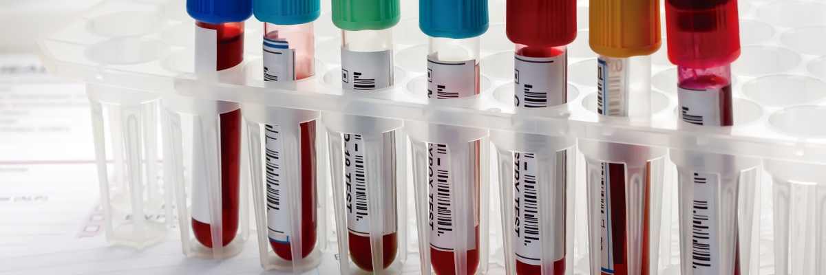 Biomarkers for cardiovascular disease